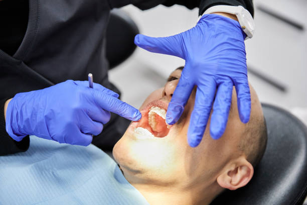 Best Emergency Wisdom Tooth Extraction in Cocoa, FL